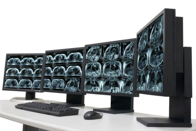 Fujifilm Acquires the Digital Pathology Technology Assets of Inspirata